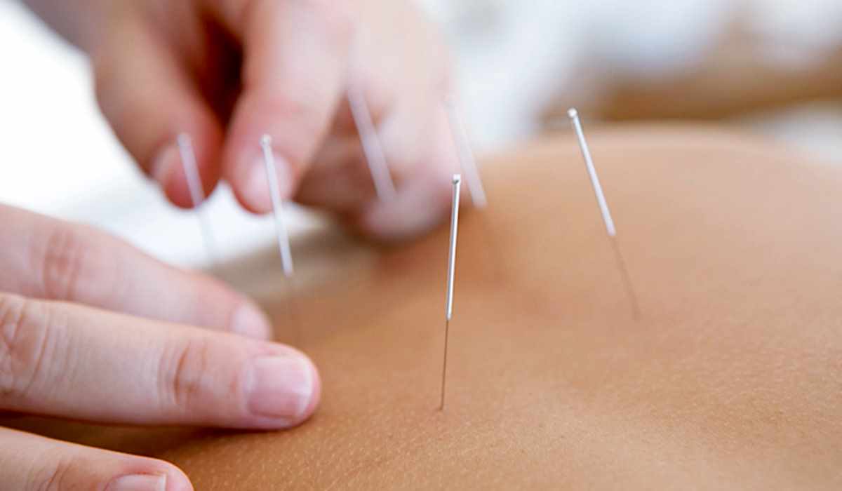 L'agopuntura potrebbe diventare la nuova frontiera contro il dolore da cancro