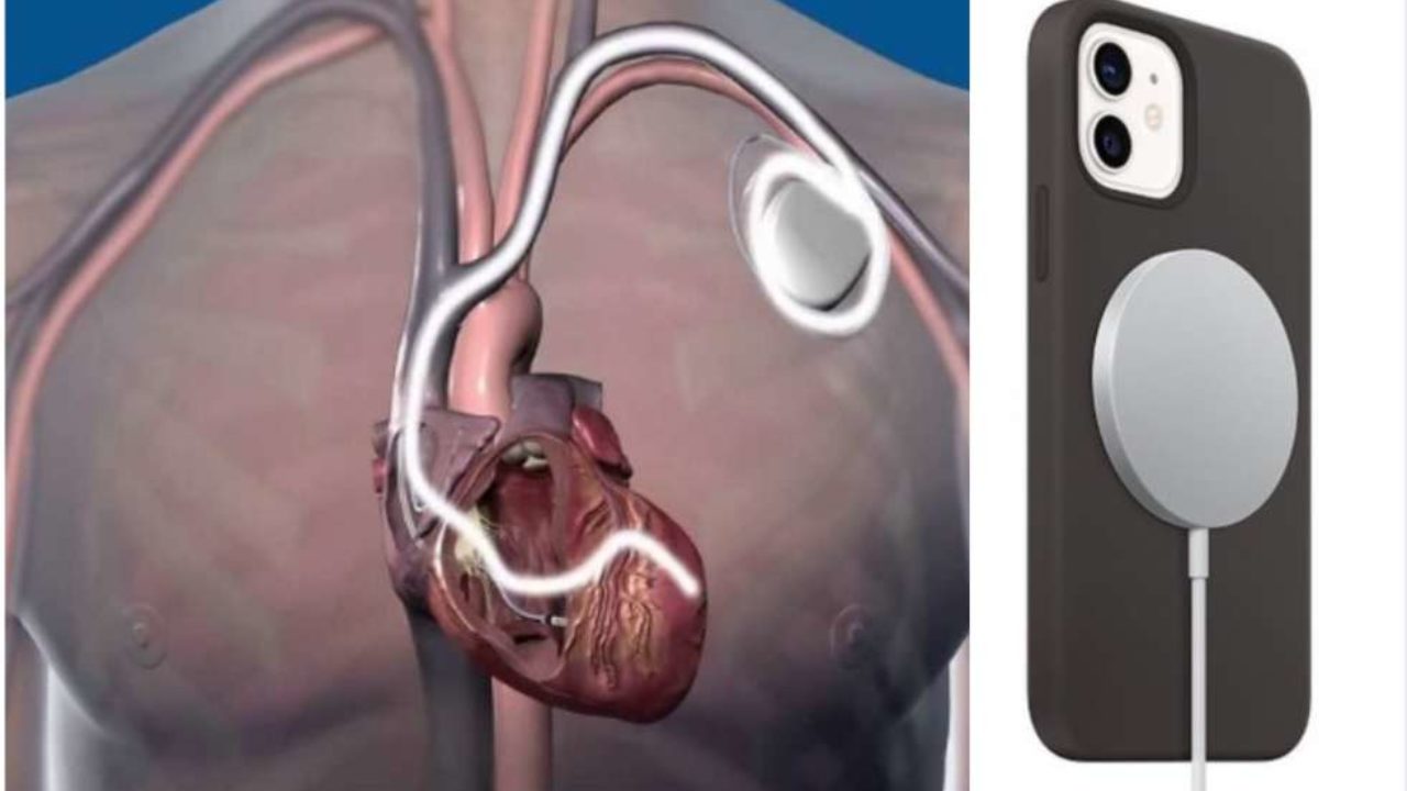 ISS: il magnete nell'iPhone 12 può essere un problema per chi ha il pacemaker