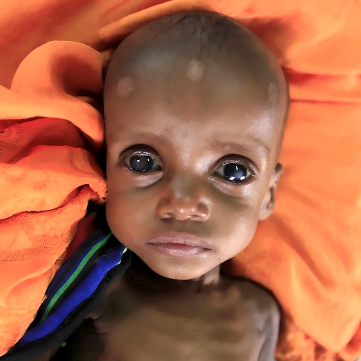 Prima la siccità, adesso la crisi alimentare: in Somalia saranno 1,5 milioni i bambini sotto i 5 anni a soffrire di malnutrizione entro il 2024