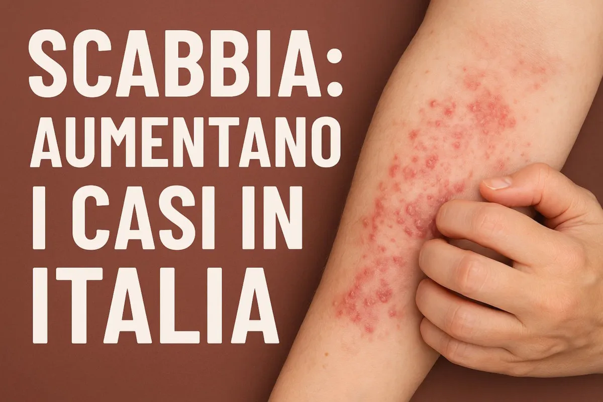 Scabbia: il ritorno inatteso di un parassita antico