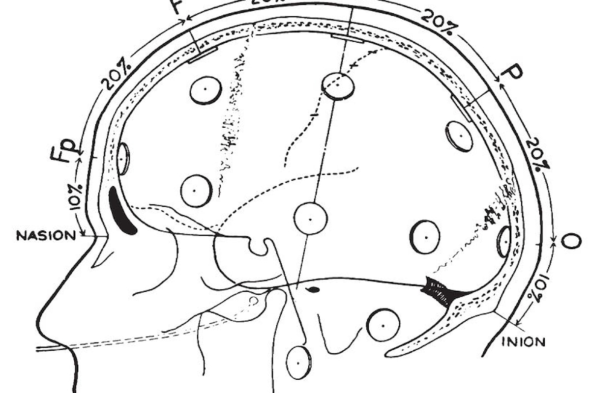 Come funzione e cos'è l'ElettroEncefaloGrafo